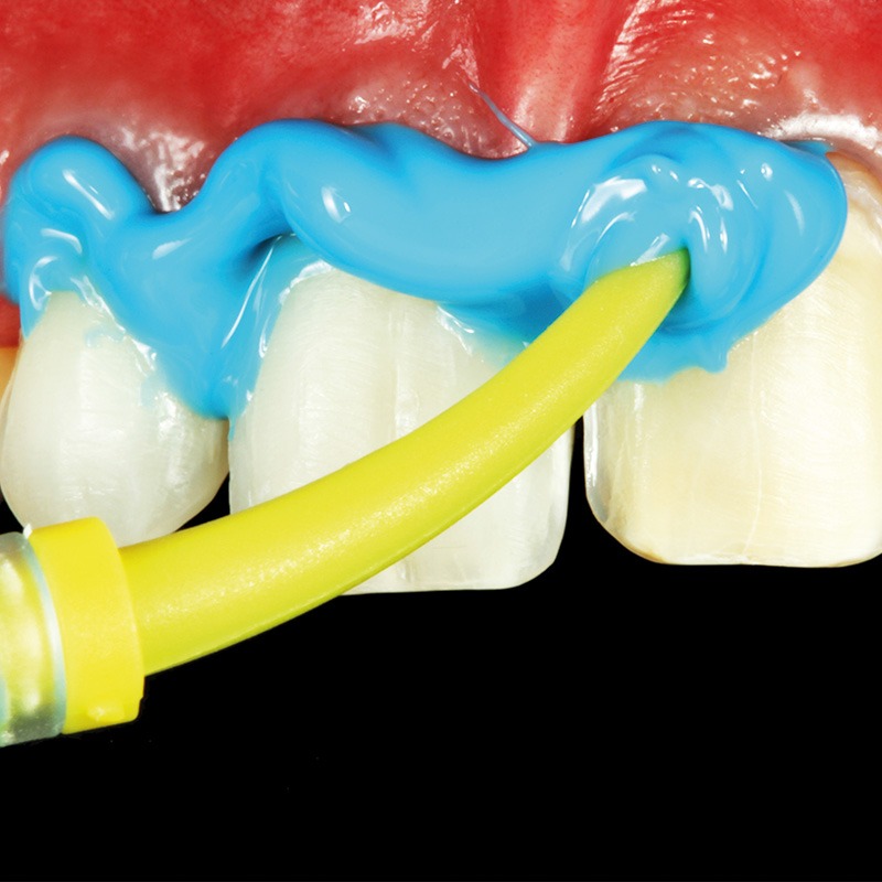 Zhermack Elite Hd+ Soft Putty And Light Body