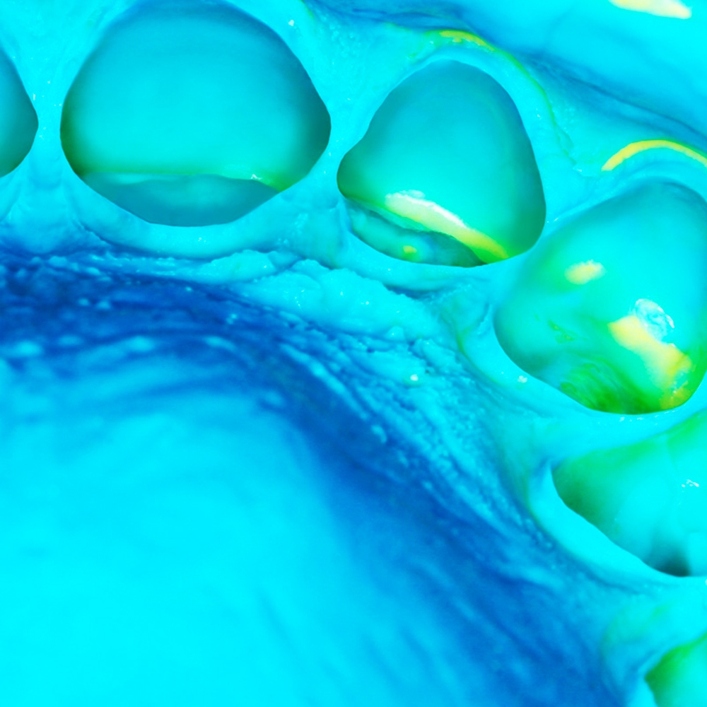 Zhermack Elite Hd+ Soft Putty And Light Body