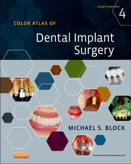 Color Atlas Of Dental Implant Surgery - 4th Edition (ISBN - 759682)