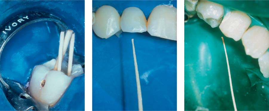 Waldent Paper Points 2% #15-40