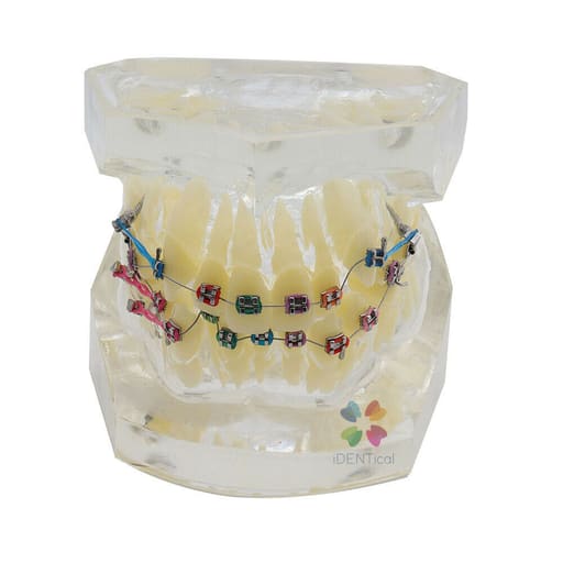 iDENTical Dental Orthodontic Model M3005-2