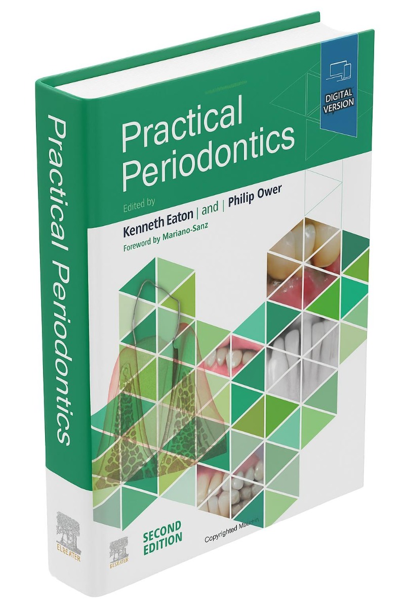 Practical Periodontics 2nd Edition (ISBN - 878456)