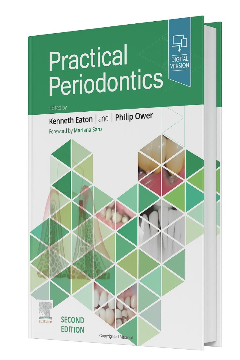 Practical Periodontics 2nd Edition (ISBN - 878456)