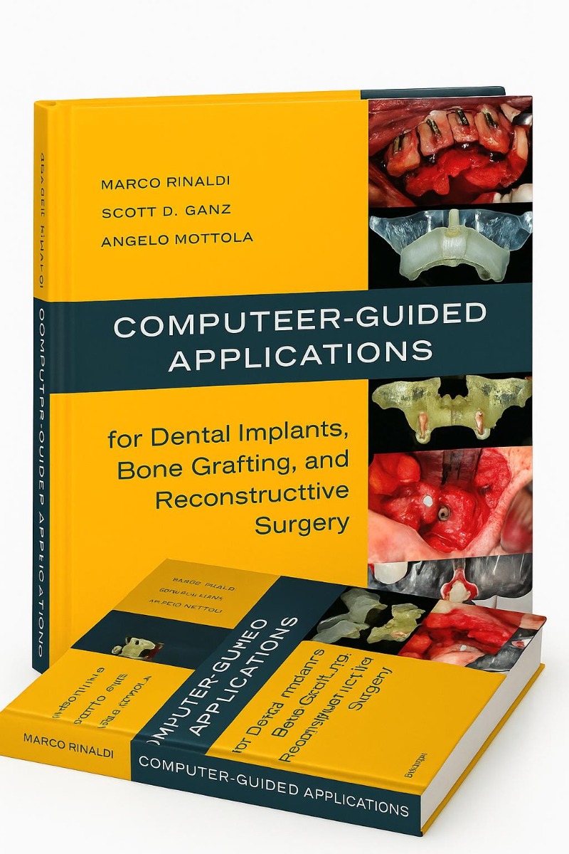 Buy Computer-guided Applications For Dental Implants, Bone