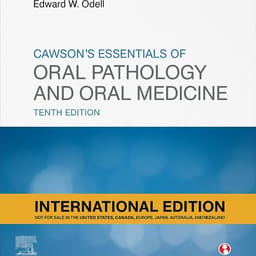 Cawson's Essentials Of Oral Pathology And Oral Medicine 10th International Edition (ISBN - 935739) - 4