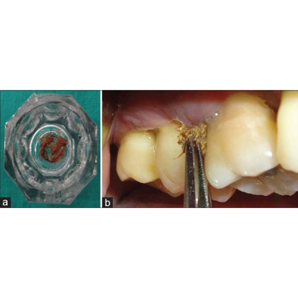 Advanced Biotech Periodontal Plus Ab