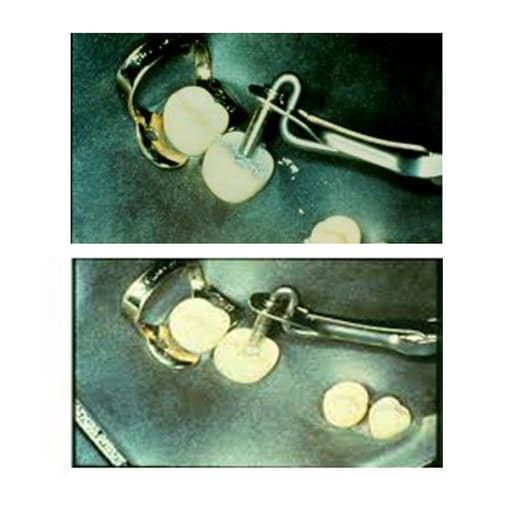 GDC Amalgam Carrier Double Ended - Jumbo/Regular (AC5203)
