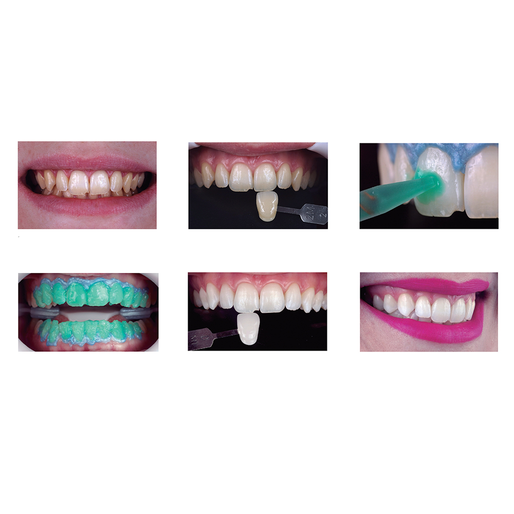 FGM Whiteness HP Automixx 35%