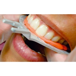Prime Dental Bite Registration Putty - 4