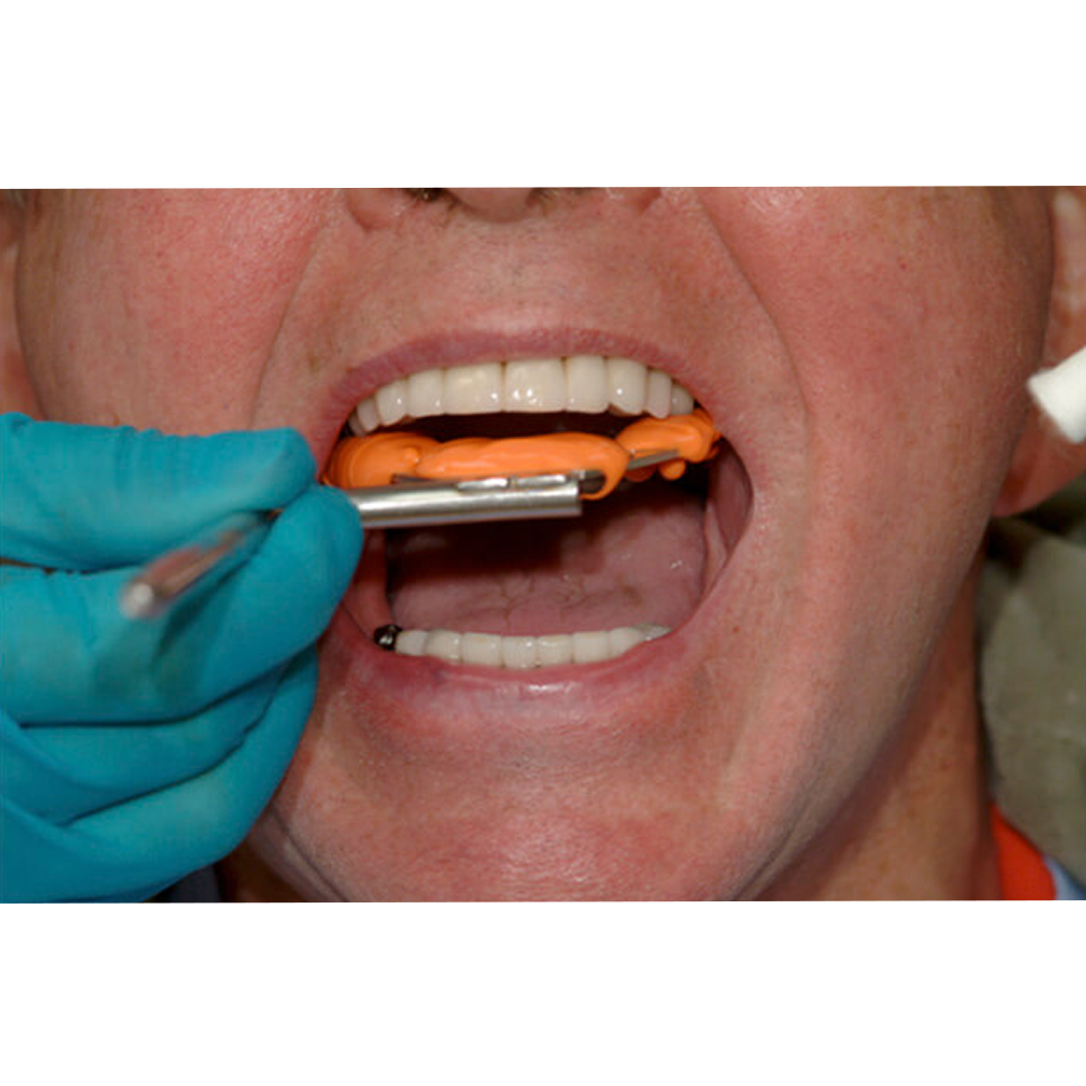Prime Dental Bite Registration Putty