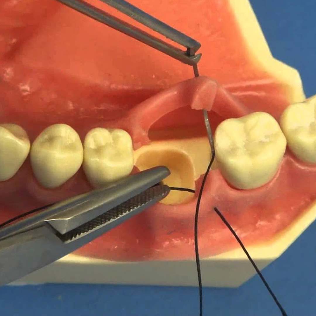 Waldent Needle Holder Mayo-Hegar 140mm,150mm,160mm & 180mm