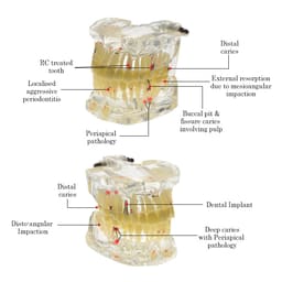 iDENTical Adult Pathologies Model M4001-1 - 7