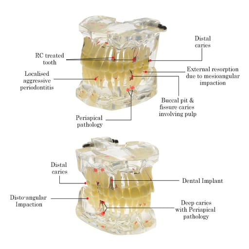 iDENTical Adult Pathologies Model M4001-1
