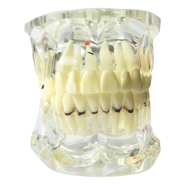 iDENTical Adult Pathologies Model M4001-2