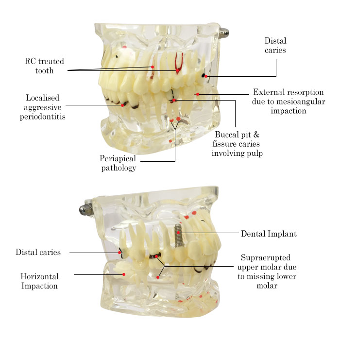 iDENTical Adult Pathologies Model M4001-2