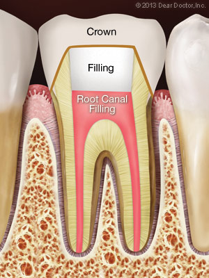 Prime Dental Rc Fill