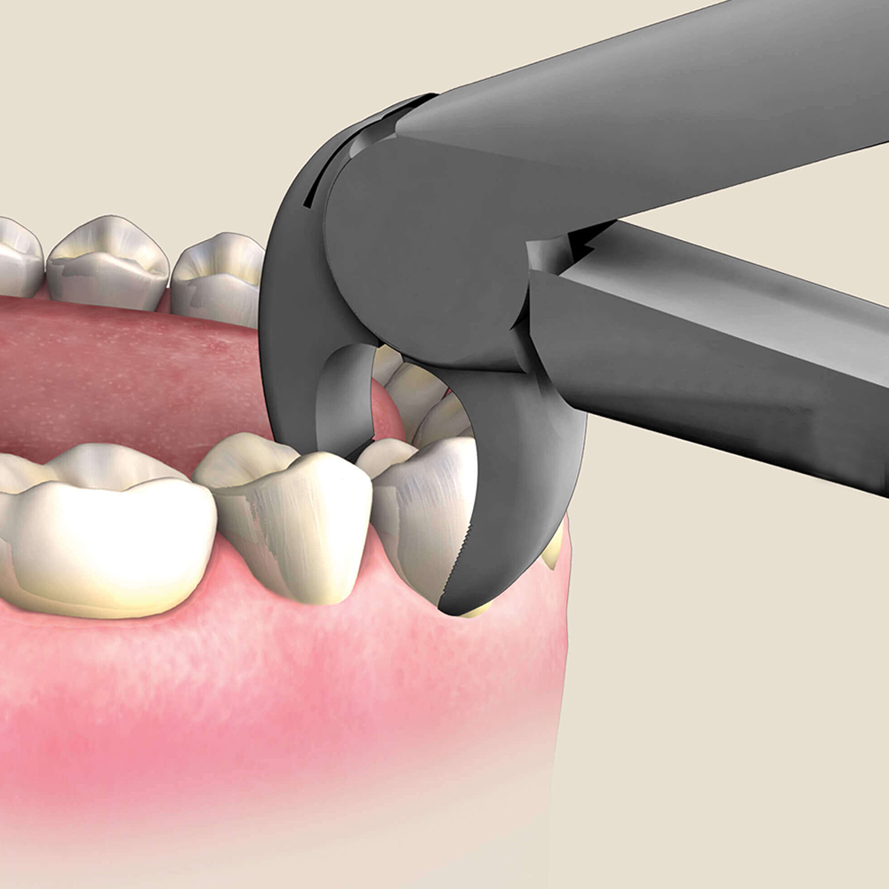 GDC Extraction Forceps S/12 With Cassette Instruments Kit (EFPWC12)