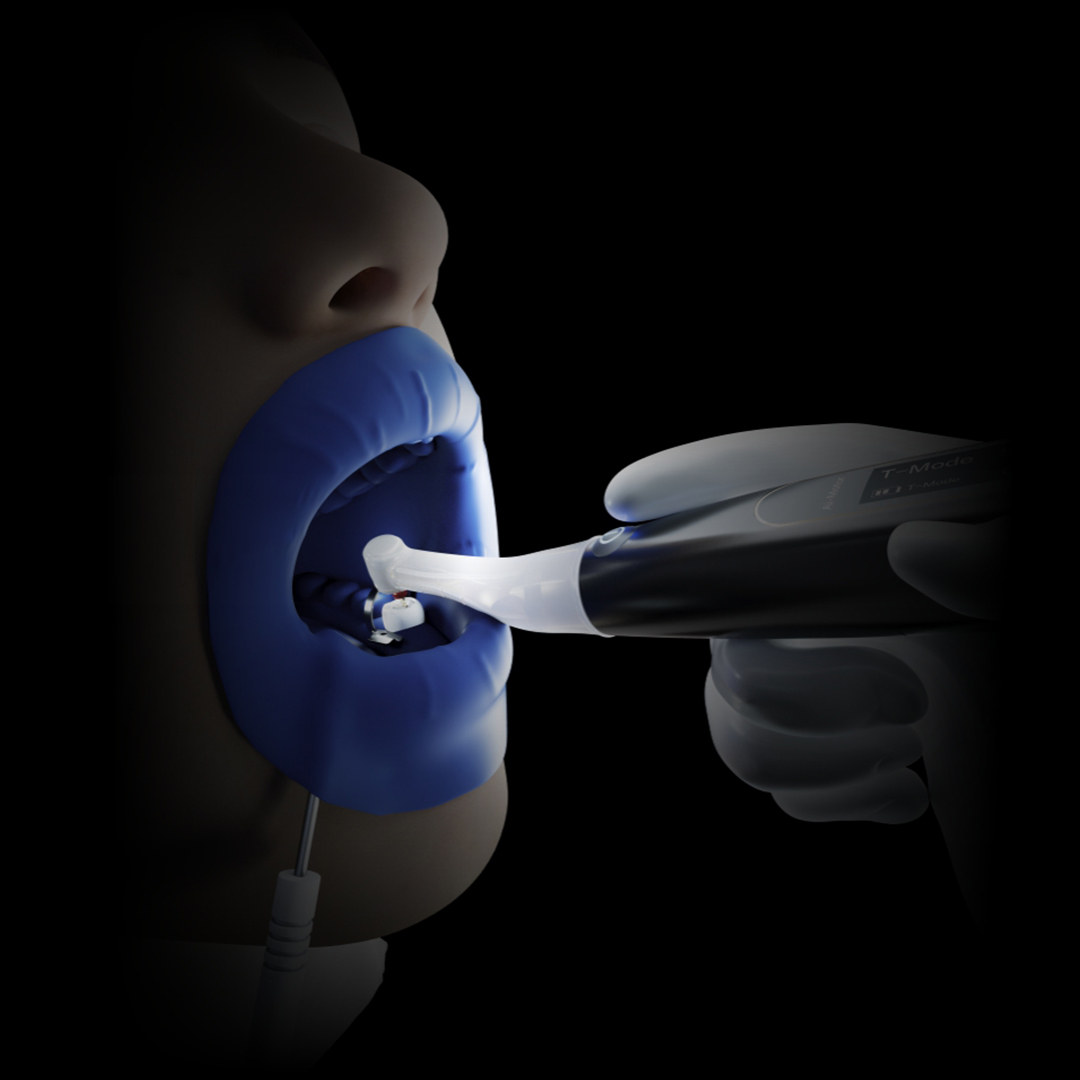 Woodpecker Ai - Motor Endomotor With Apex Locator