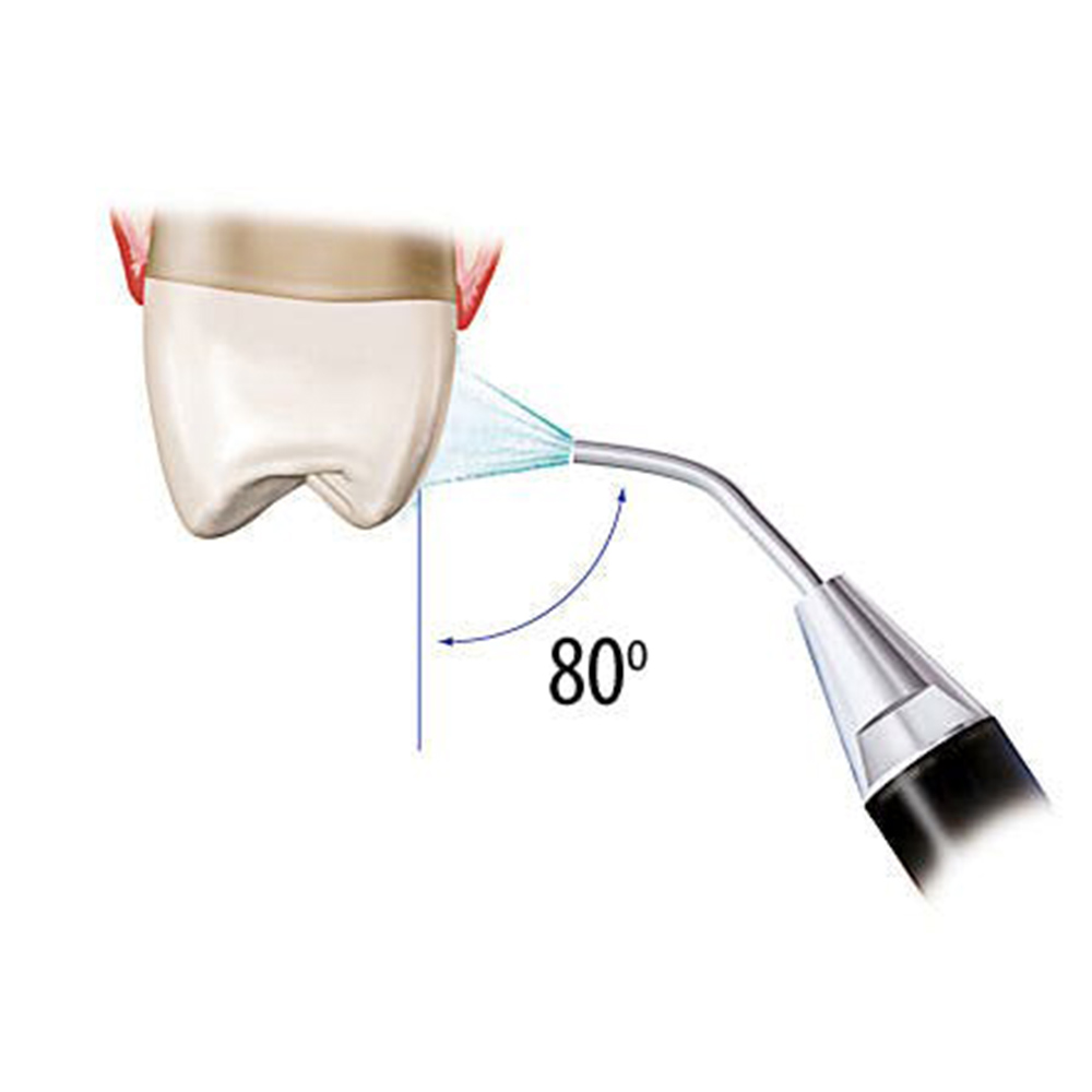 EndoKing Prophyshine Air Polisher