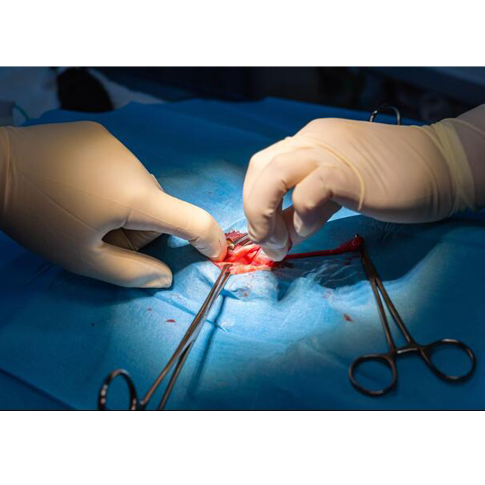 GDC Allis Forceps 5x6 (15cm) (TFS)