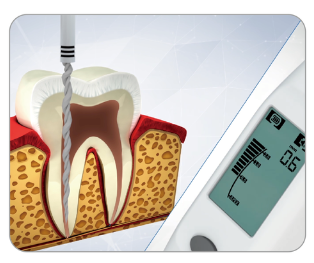 Marathon Endo A Class (APX) Endomotor with In-built Apex Locator