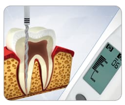 Marathon Endo A Class (APX) Endomotor with In-built Apex Locator - 4
