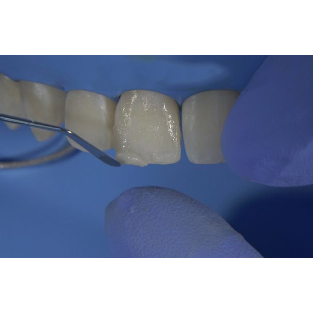 GDC Restore Instrument - Applica