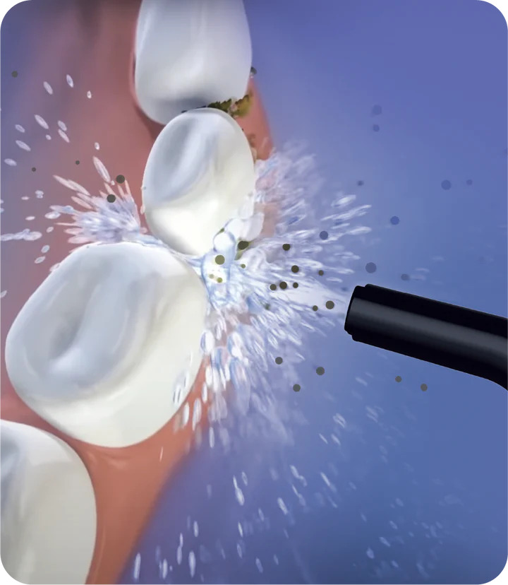 Oracura OC450 Lite Countertop Smart Water Flosser