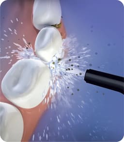 Oracura OC450 Lite Countertop Smart Water Flosser - 8