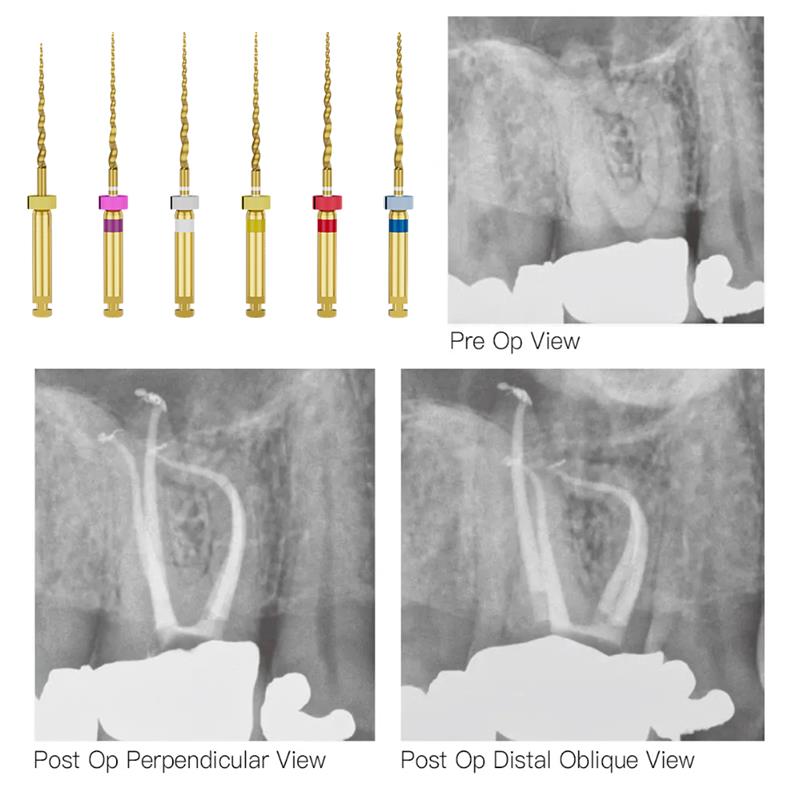 Endo Excellence Nano Gold Rotary Files -21mm (Pack of 6)