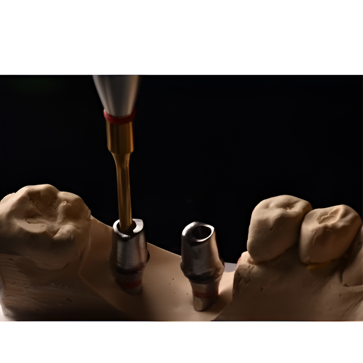 Mediden Dental Implant Lab Mini Screw Driver kit With Box (Set of 8 Drivers)