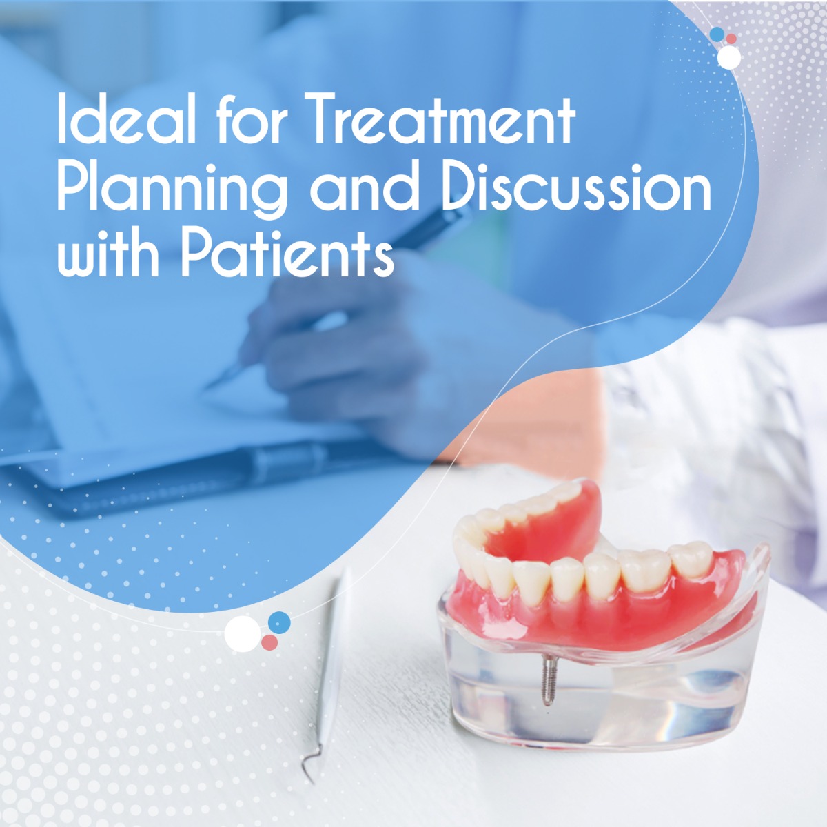 iDENTical Mandibular Overdenture Model with 2 Implants M6002