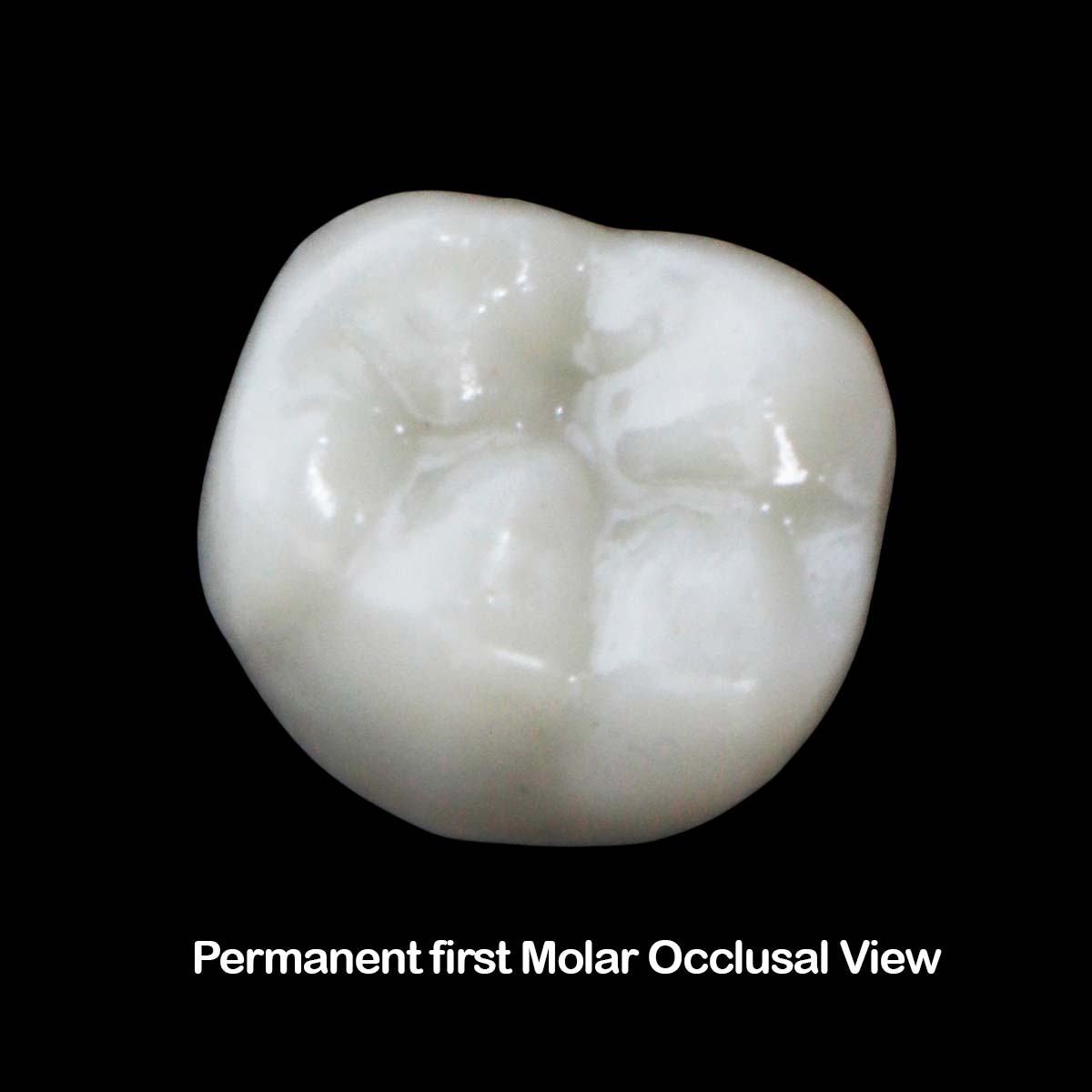Pedo Crown Permanent 1st Molar Kits