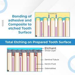 Waldent BESTEtch - 8