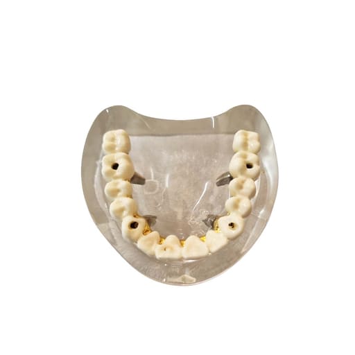 Julldent All On 4 Paulo Malo Models With Prosthesis 