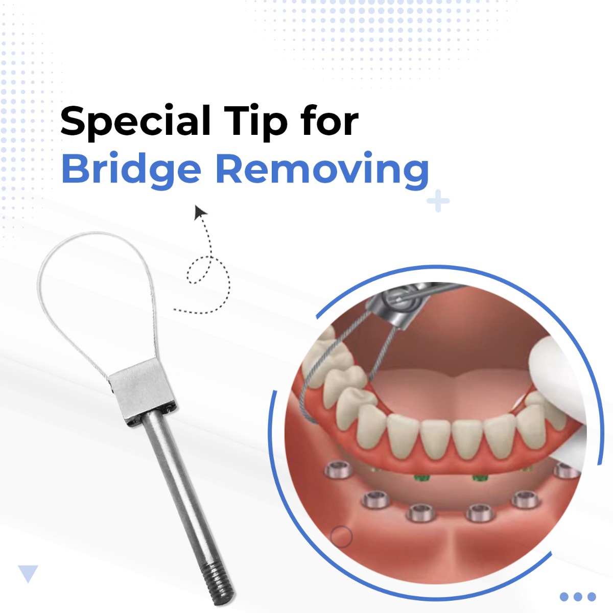 Waldent Automatic Crown Remover Instruments Kit (K21/5)