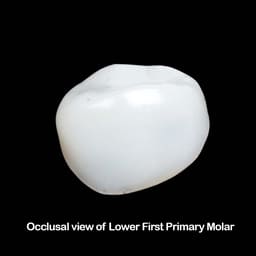 Pedo Crown Primary Molar Kits - 3