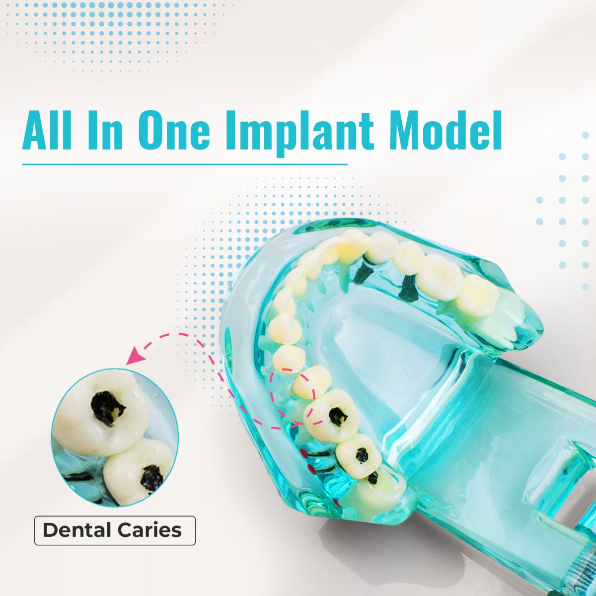 iDENTical All In One Implant Models M2001