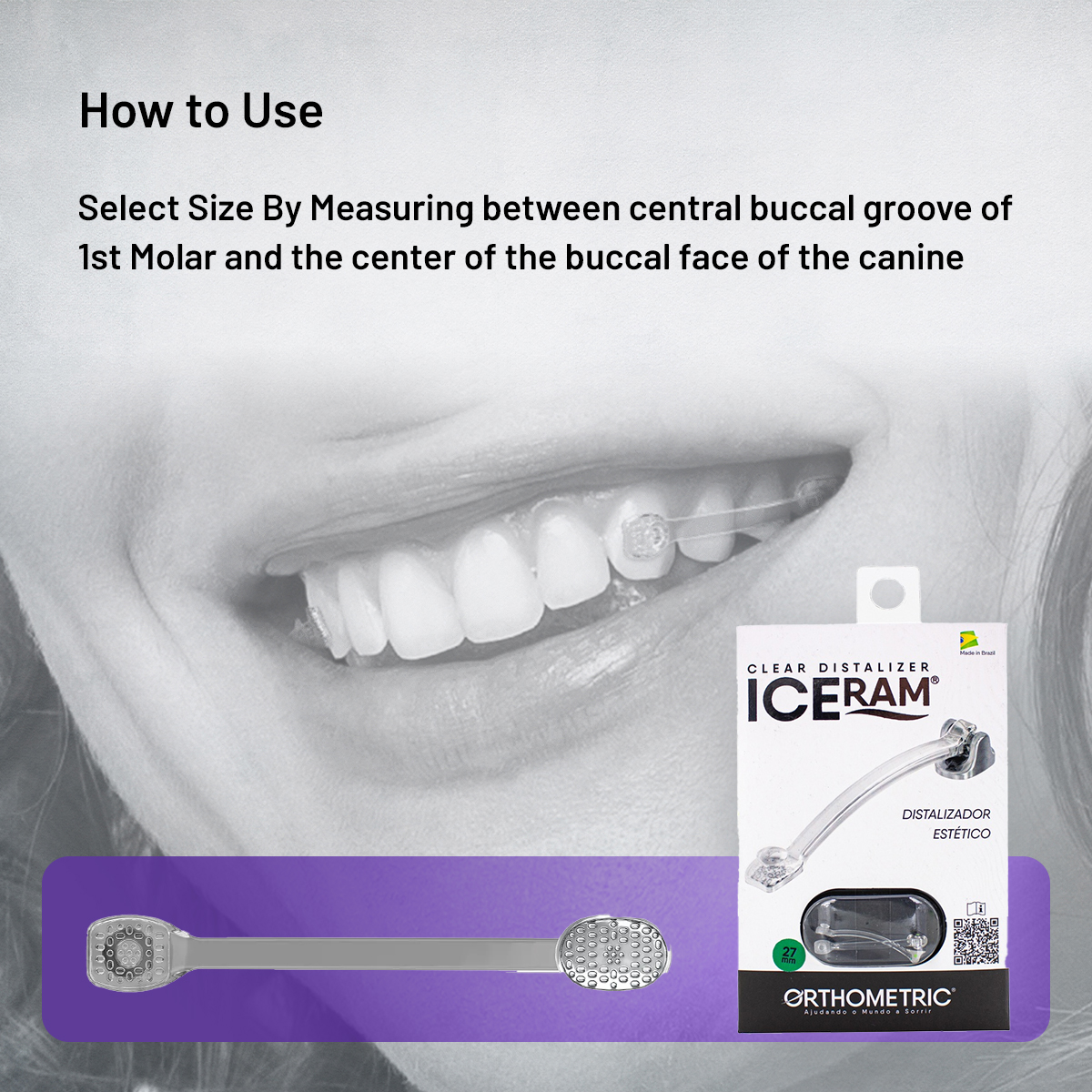 OrthoMetric Iceram Clear Distalizer (2/Pk)