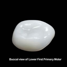 Pedo Crown Primary Molar Mini Kits - 3