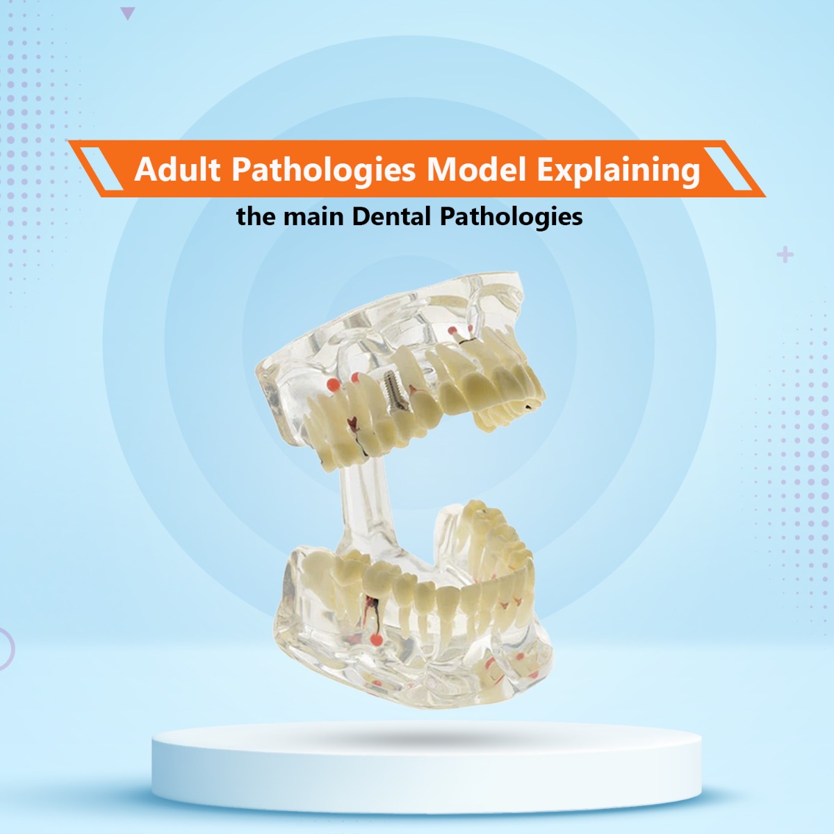 iDENTical Adult Pathologies Model M4001-1