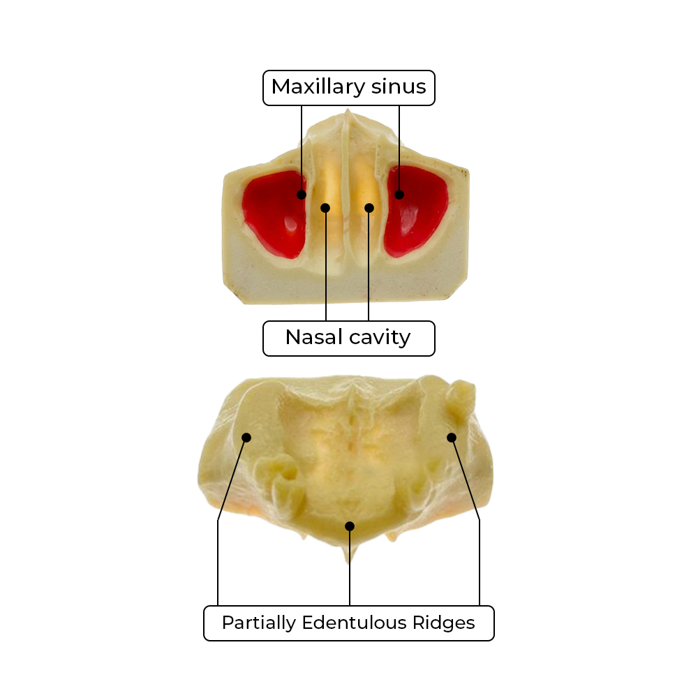 iDENTical Sinus Lift Practice Model M2013F