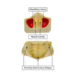 iDENTical Sinus Lift Practice Model M2013F - 2