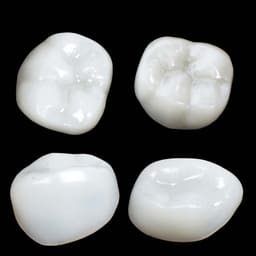 Pedo Crown Primary Molar Kits - 5