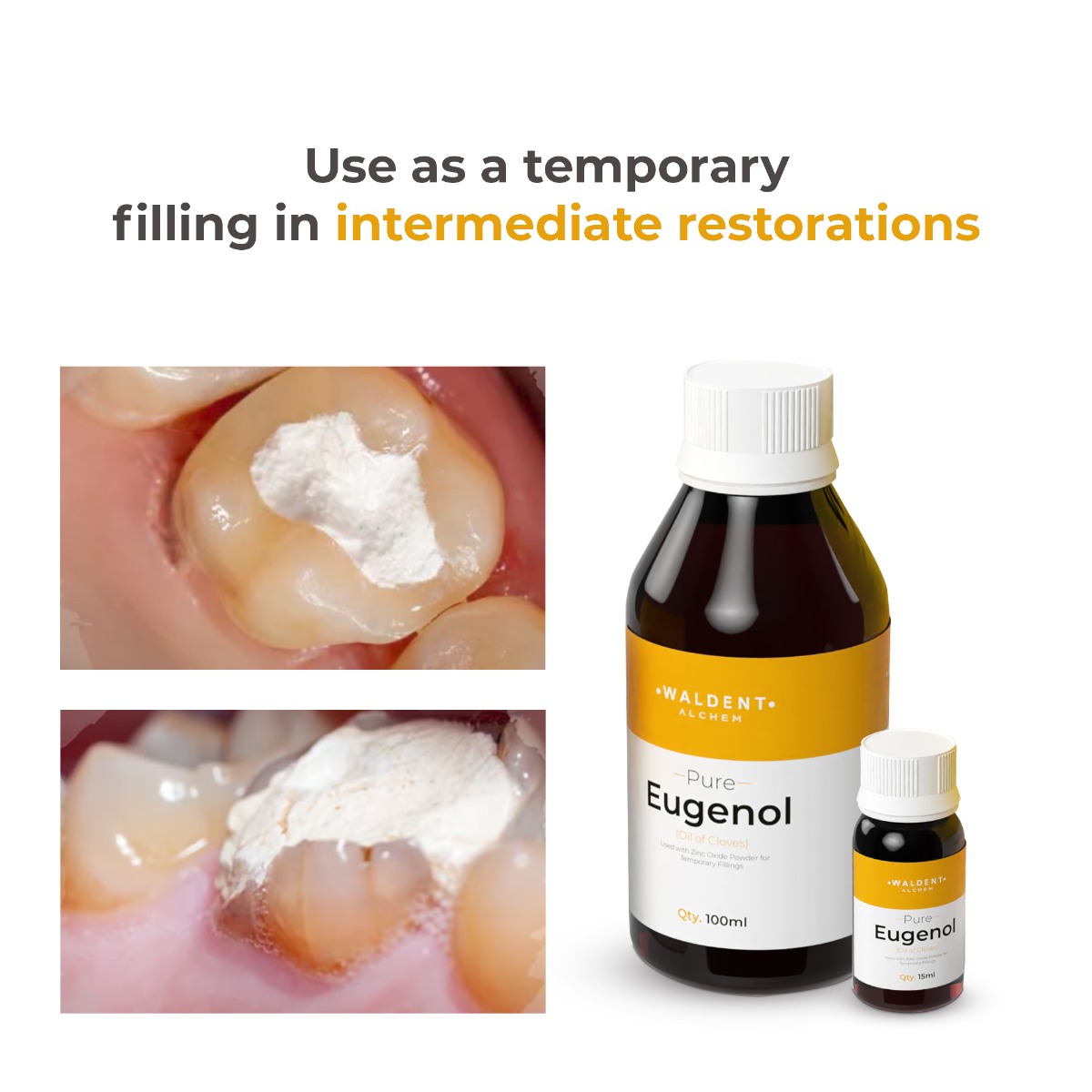 Waldent Pure Eugenol