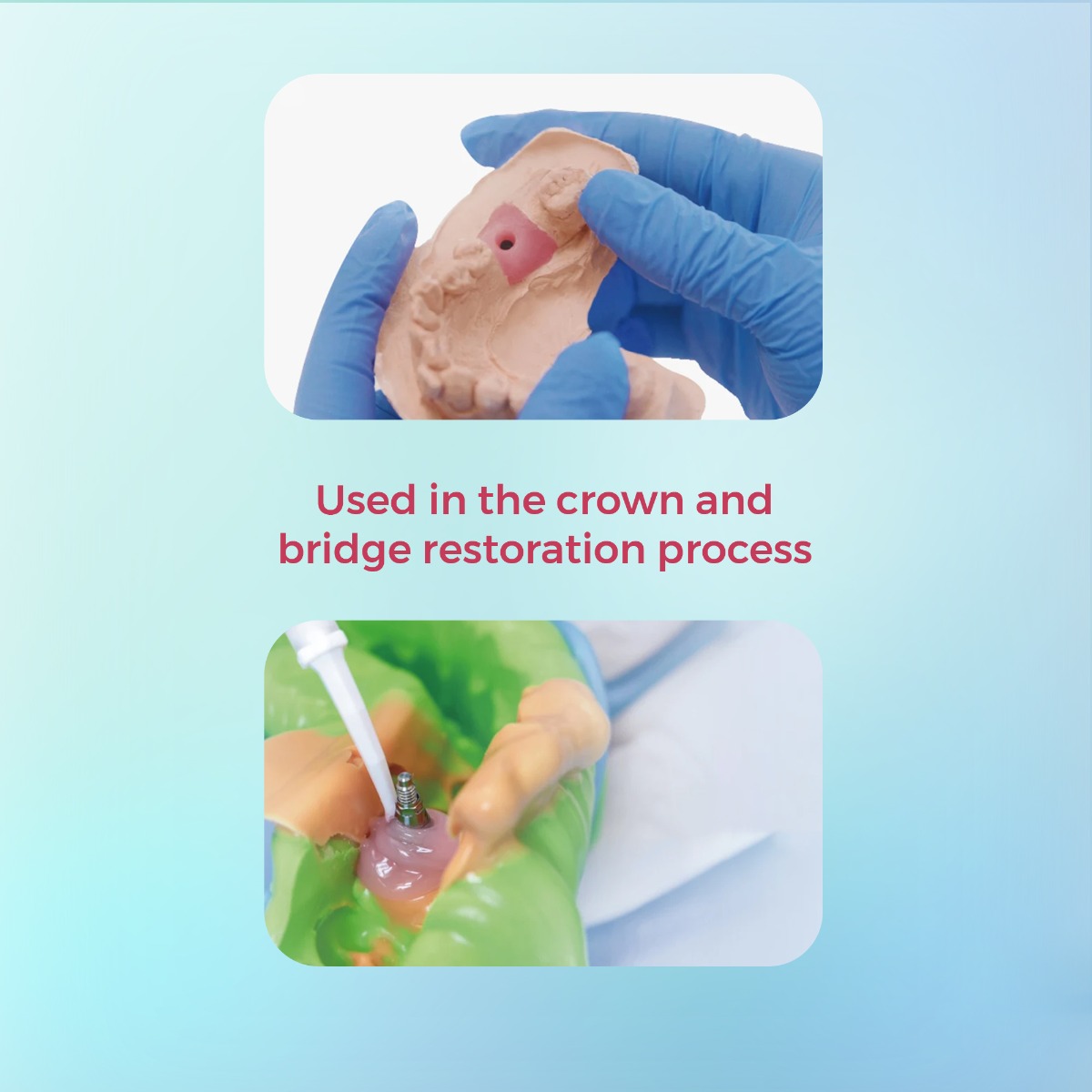 Waldent FlexiGum Gingival Mask (50mlx2)