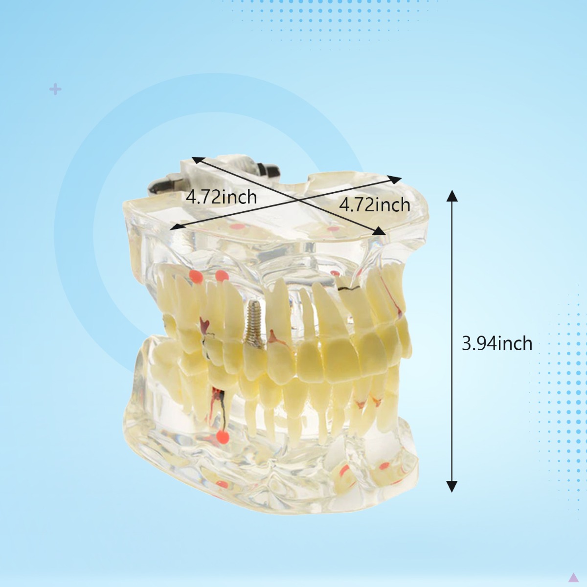 iDENTical Adult Pathologies Model M4001-1
