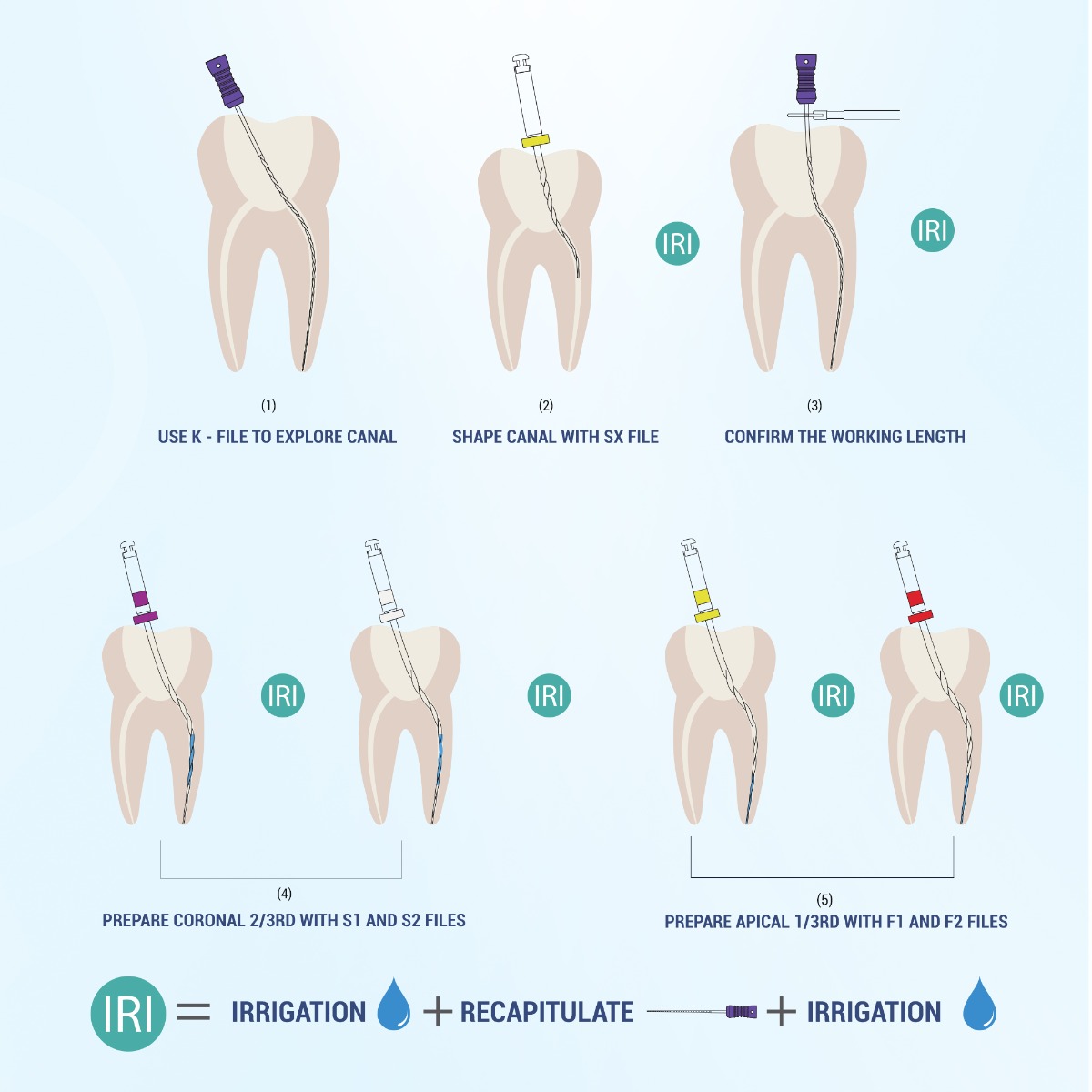 Endo Excellence Nano Gold Rotary Files -25mm (Pack of 6)