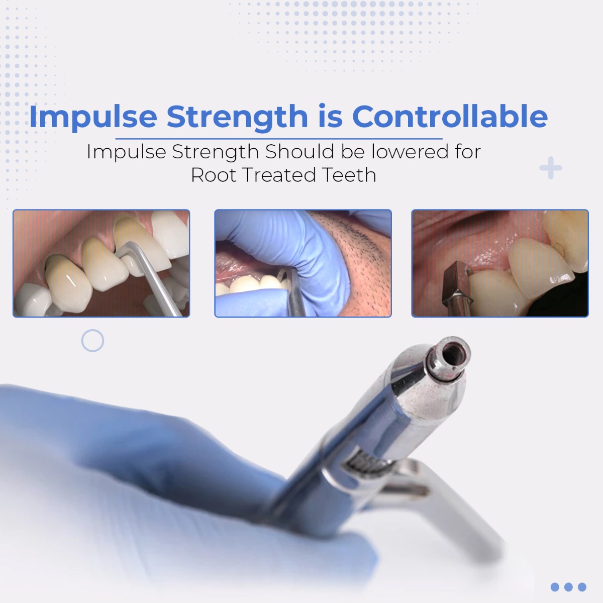 Waldent Automatic Crown Remover Instruments Kit (K21/5)