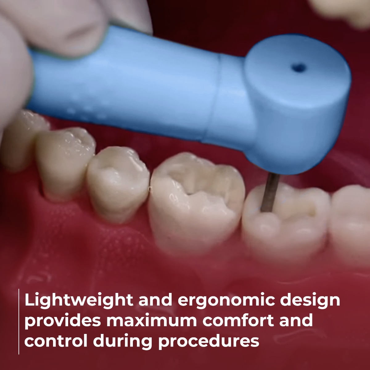 Waldent Disposable High Speed Airotor